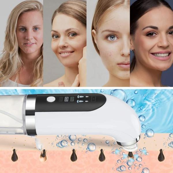 Beauty Blackhead Vacuum Facial - Skincare - HealthCare™